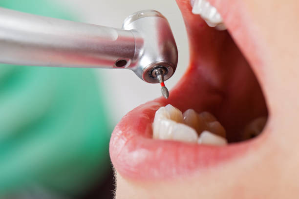 Best Emergency Treatment for Oral Infections in Savannah, TN